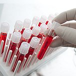 Нужно ли в период ГВ делать анализ крови матери на какие-либо витамины и микроэлементы? (задали 32,13% женщин)